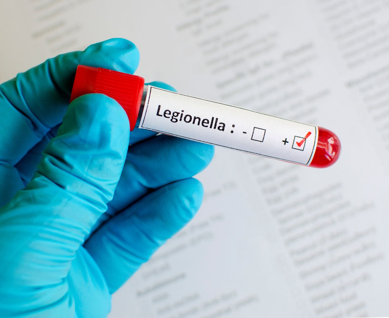 legionella